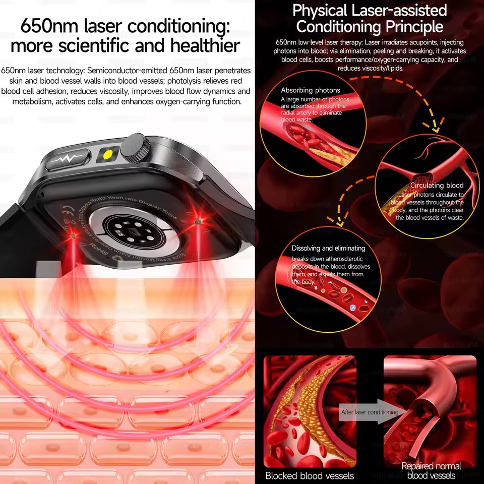 2026年新型健康スマートウォッチ、レーザー療法で高血圧、高 - Industrial Laser Beam のレビューと価格